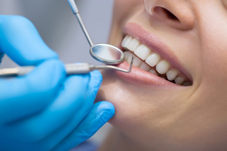 Dental Services to Help You Look and Feel Your Best